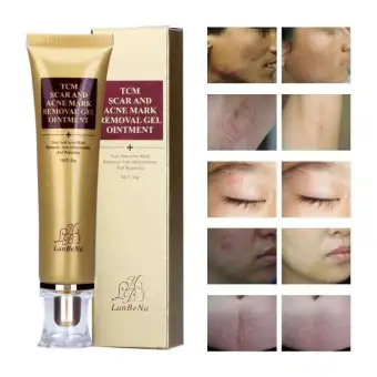 tcm scar and acne mark removal gel ointment price
