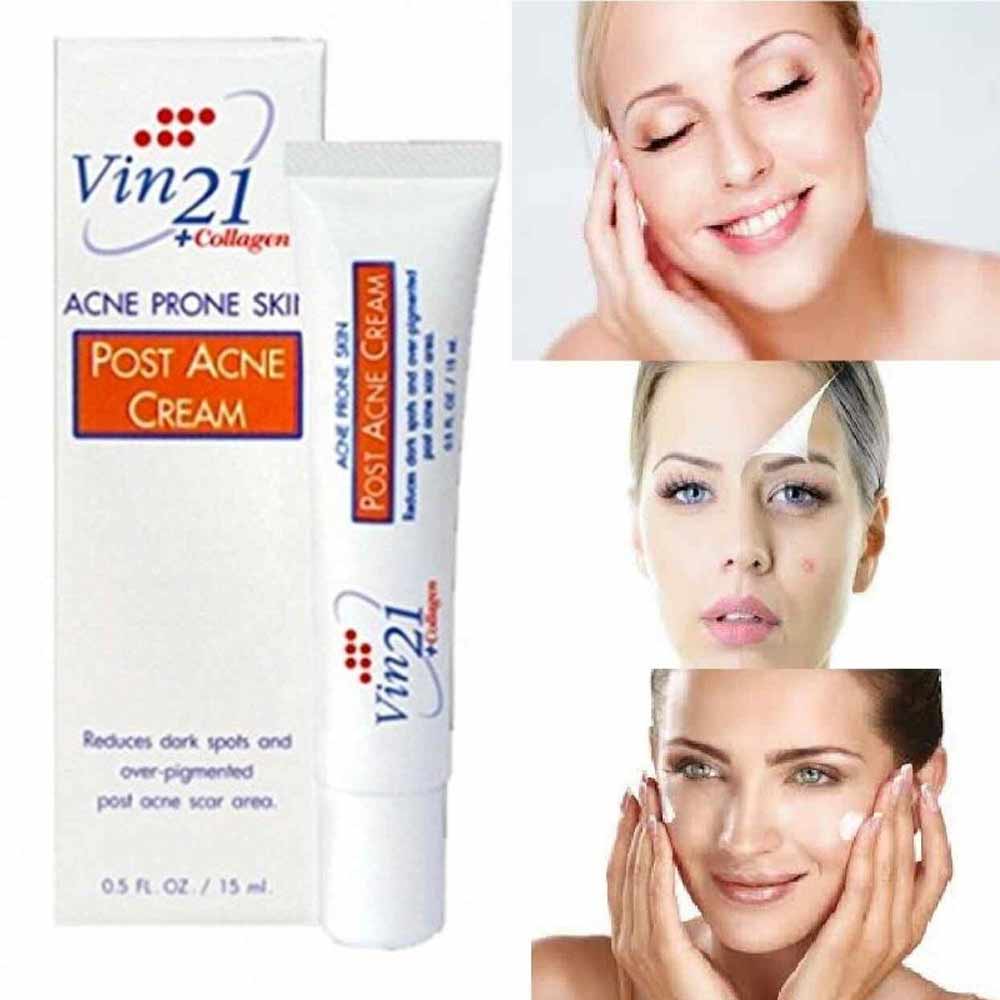 Vin21 Anti Acne Cream 15ml