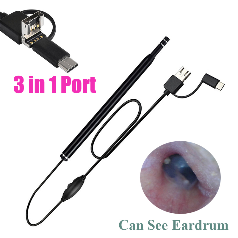 【Hengli jewelry story】Medical USB Ear Cleaning Tool HD Visual Earwax Spoon Earpick Otoscope with Mini Camera Pen Ear Care In-ear Cleaning Endoscope