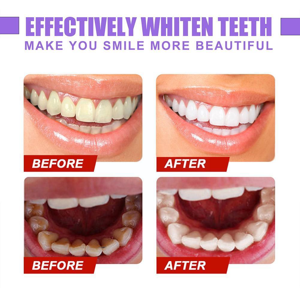 【Happy baby toy store】EELHOE V34 Toothpaste Purple Orange Toothpaste Repair Teeth Repair Oral Cleaning Dazzling Whitening and Staining Removal. 