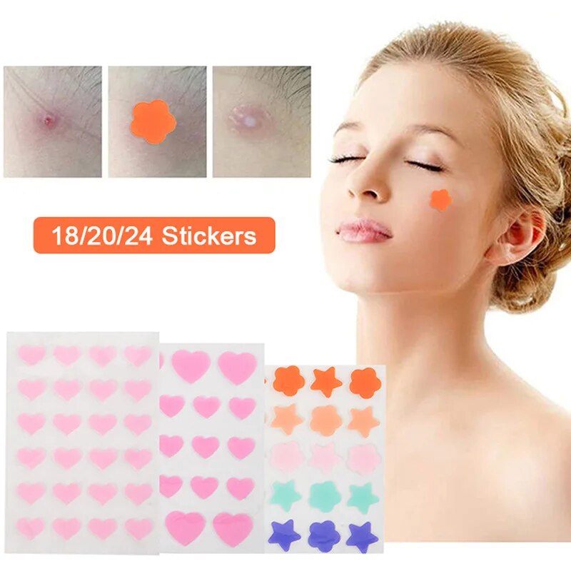 【hot】 Cute Heart Flower Invisible Pimple Patch Face Spot Scar Care Stickers Makeup Concealer Tool Beauty Acne Tools. 