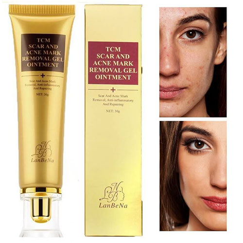acne scar removal products
