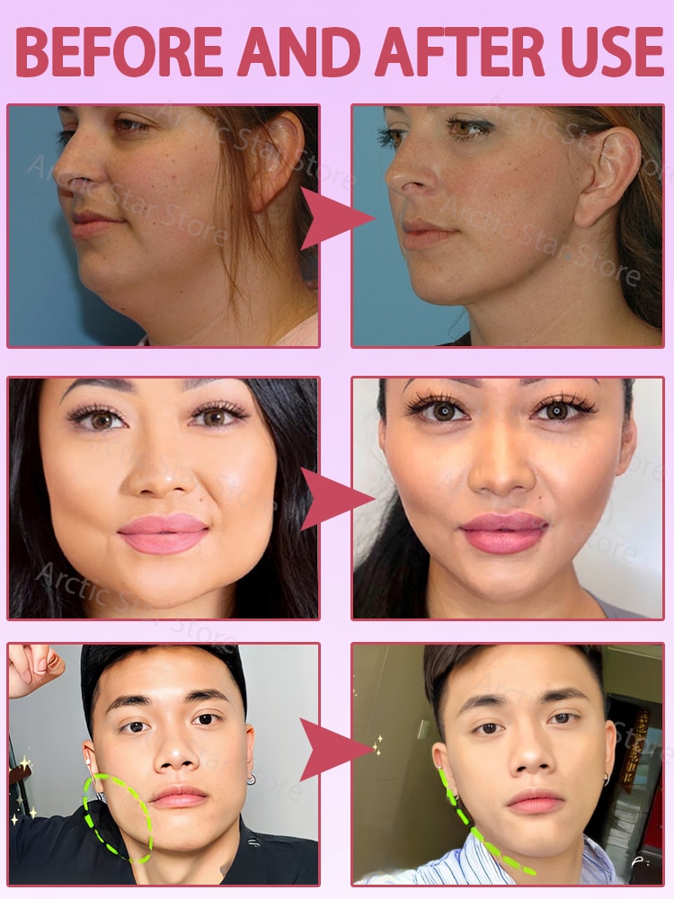 Slimming Face Cream Remove Double Chin Lift Products. 
