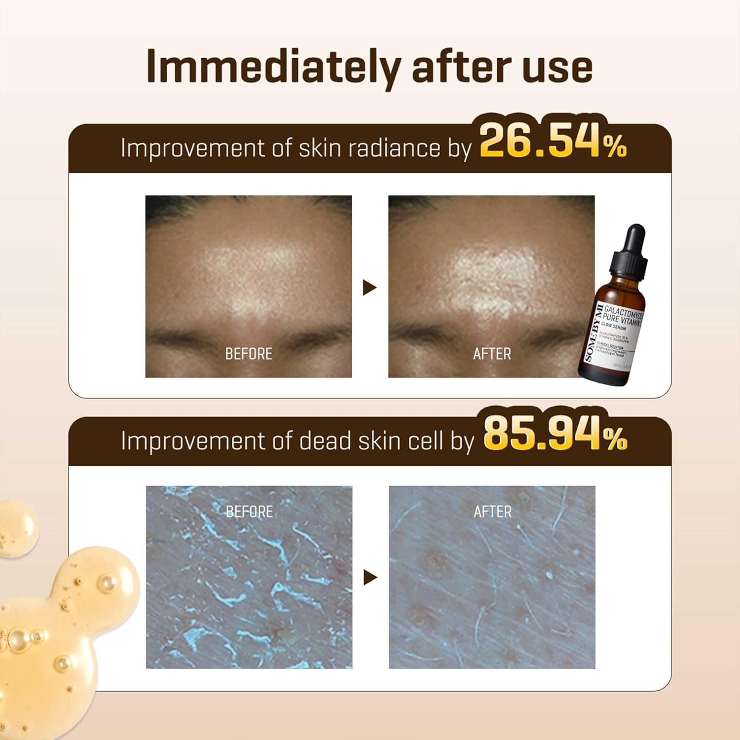 Some By Mi Galactomyces Pure Vitamin C Glow Serum 30ml. 