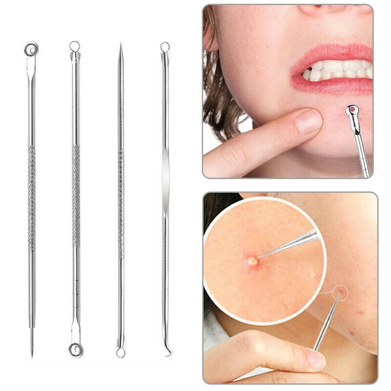 Professional Pimple Popper Tool Kit - With Comedone Extractor, Milia Removal Tool, Blackhead Tweezers, and Whitehead Remover Tool, Spot Treatment Acne Set. 