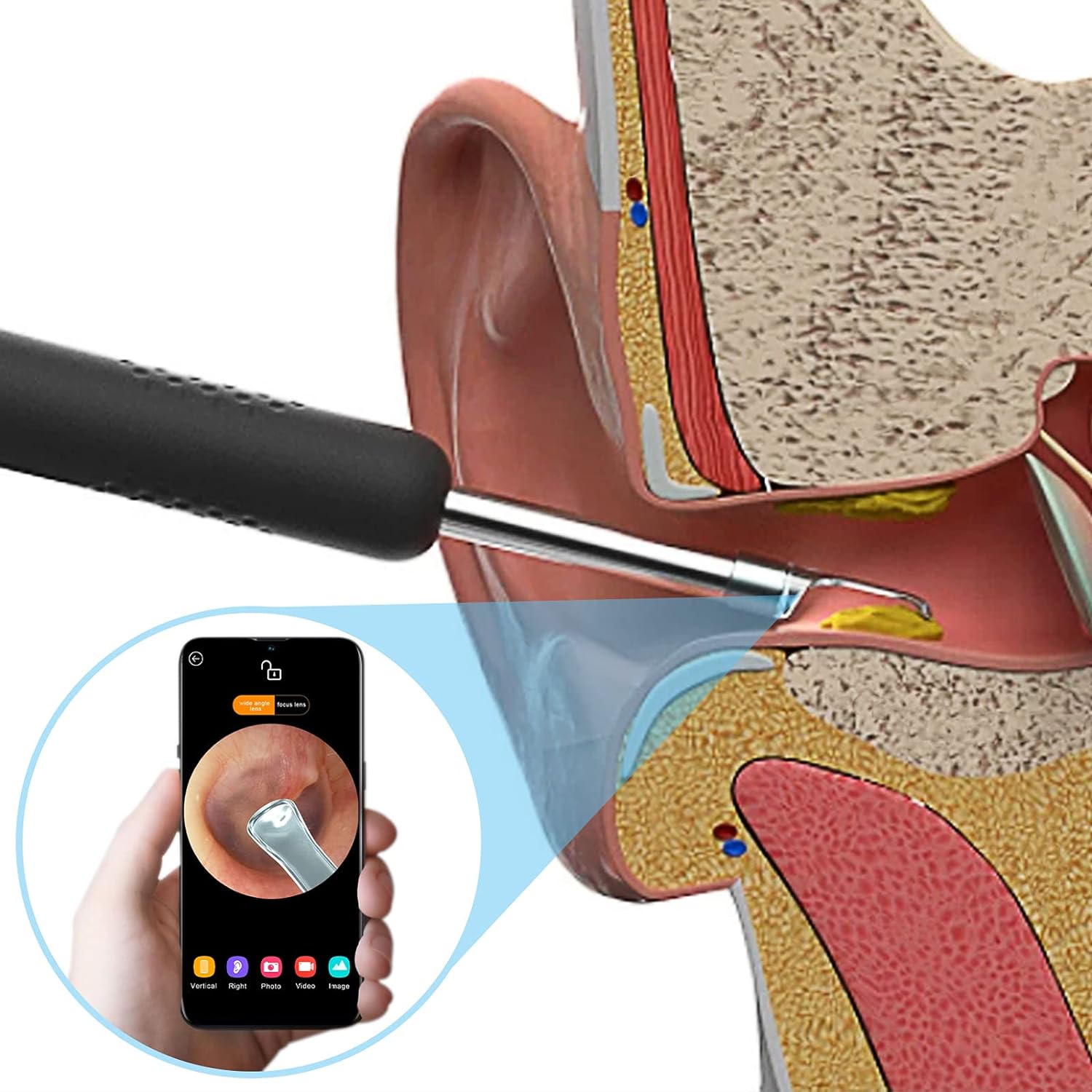 Xiaomi Bebird R1 Wireless Intelligent Visual Ear Stick Precision Endoscope. 