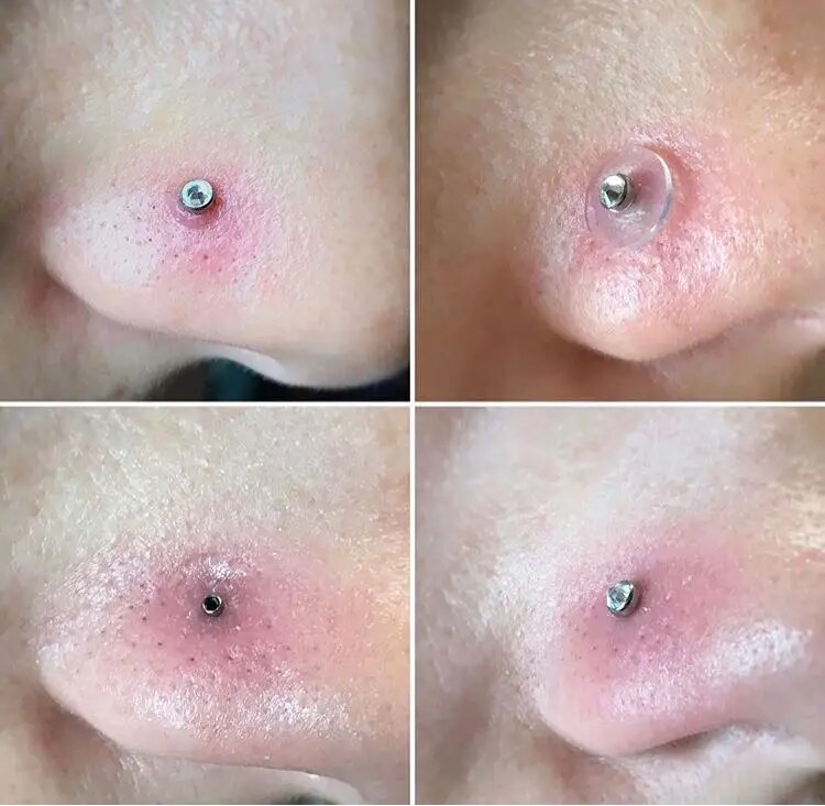 Piercing Healing Silicone Discs Soft Anti Hyperplasia Anti-sagging Fixed Rings for Nose Ear Cartilage Soft Gasket Spacers body