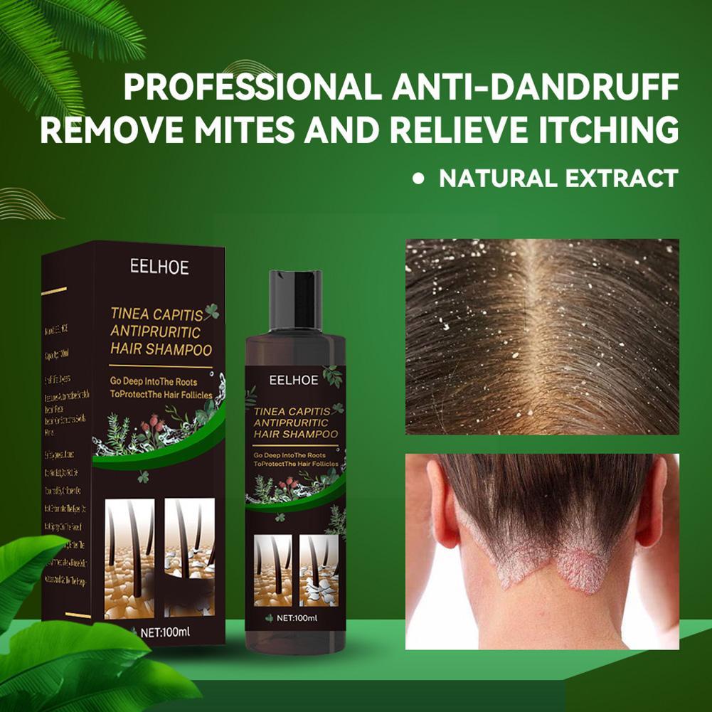 EELHOE 100ml Tinea Dispelling Anti-itching Shampoo Anti-dandruff Shampoo Hair Shampoo Treatment Oil Refreshing Control. 