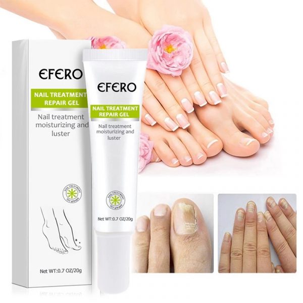 EFERO Anti Fungal Nail Repair Gel Treatment Anti Infection Serum Toe Nail Fungus Remover Nourish Essence Nail Care. 