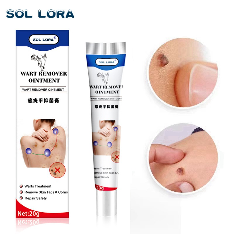 SOL LORA Cross-Border Amazon AliExpress Wart-Removing Cream Wart-Removing Flat Wart-Removing Silk Wart Cream Corns Mole Remover Cream