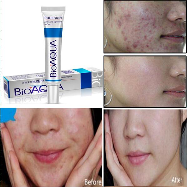 bioaqua acne rejuvenation cream ingredients