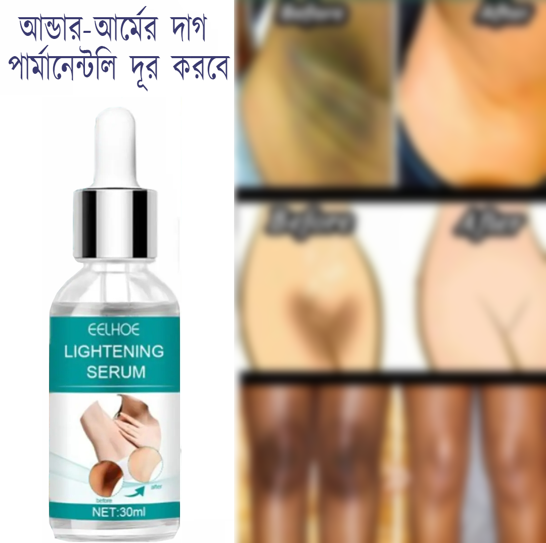 EELHOE Makes Brighter To Your Body And Posture Without Any Side Effect