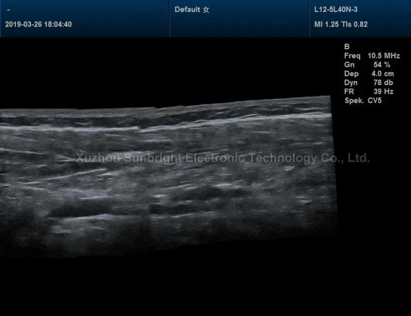 High-end Digital Medical Portable Echo Ultrasound Device 3D 4D Machine. 