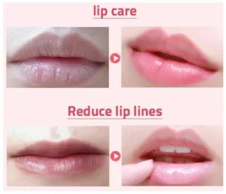 Kiss Beauty Lip Serum Essence Ultra Moisturizing Rose 5ml. 