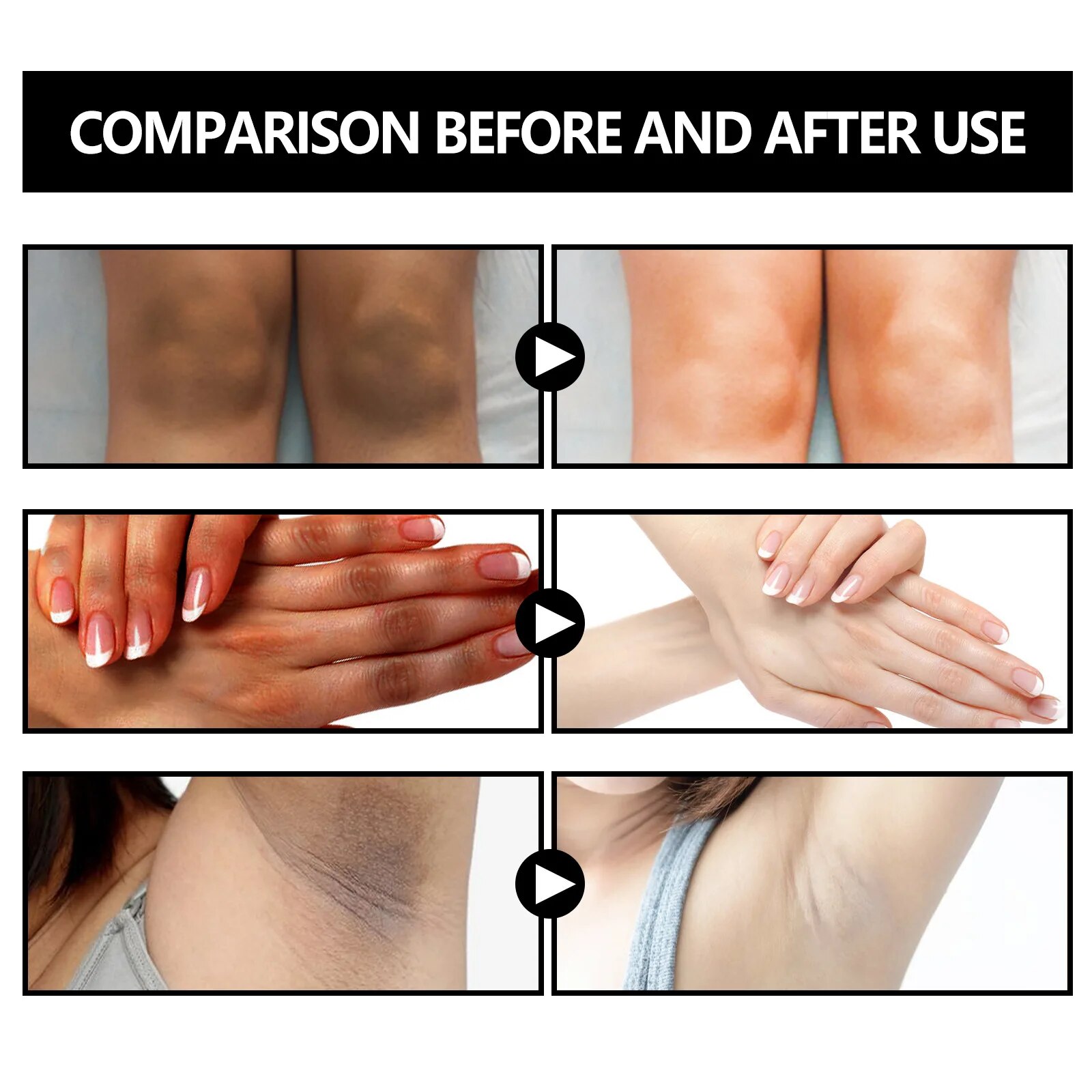Underarm Whitening Soap Deep Cleansing Remove Dark Spot Improve Pigmentation Gentle Nourishing Bleaching Melanin Handmade Soap. 
