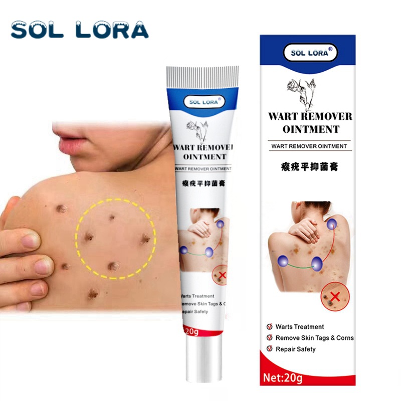 SOL LORA Cross-Border Amazon AliExpress Wart-Removing Cream Wart-Removing Flat Wart-Removing Silk Wart Cream Corns Mole Remover Cream. 