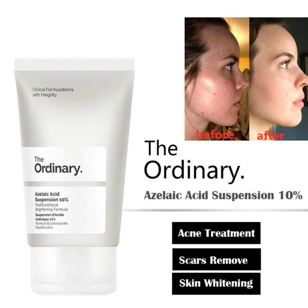 granactive retinoid acne