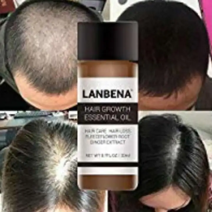 Lanbena Hair Growth Serum Organic Hair Growth Oils For Hair