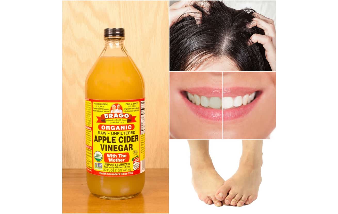 Bragg Organic Apple Cider Vinegar with The Mother (Raw - Unfiltered) - 946ml. 
