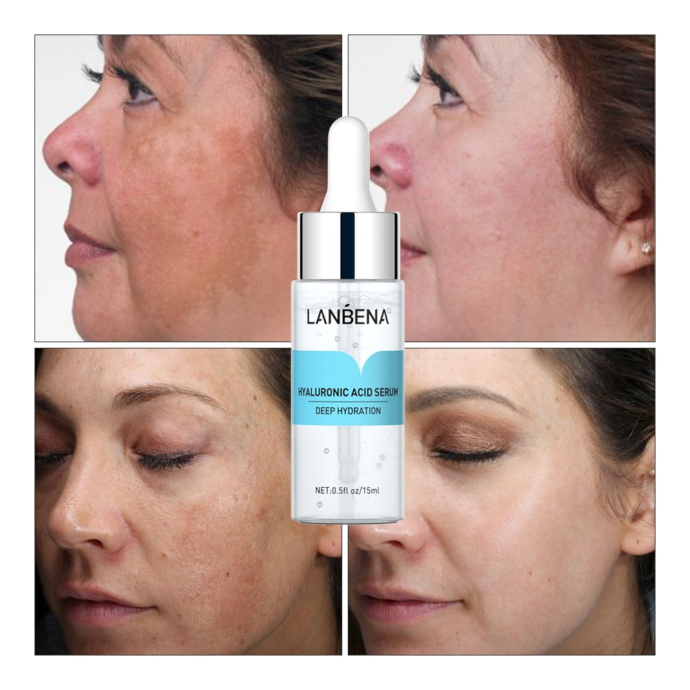 Lanbena Hyaluronic Acid Serum, LANBENA Moisturizing Serum Intense Hydration + Moisture for Dry Skin and Smooth Fine Lines Hyaluronic Serum for Face - 0.5 Fl.oz / 15 ml. 