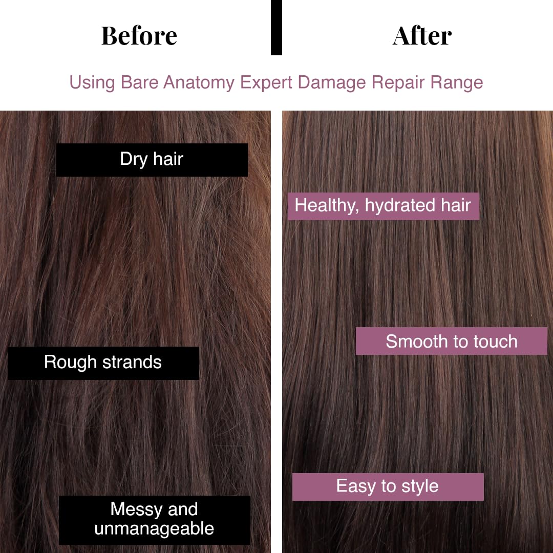 Bare Anatomy Ultra Smoothing Shampoo for Dry and Frizzy Hair | Restores Smoothing & Texture by 37% | Powered By Carbohydrate Complex & Niacinamide | SLS & Paraben Free | Vegan | For Men & Women -250ml. 