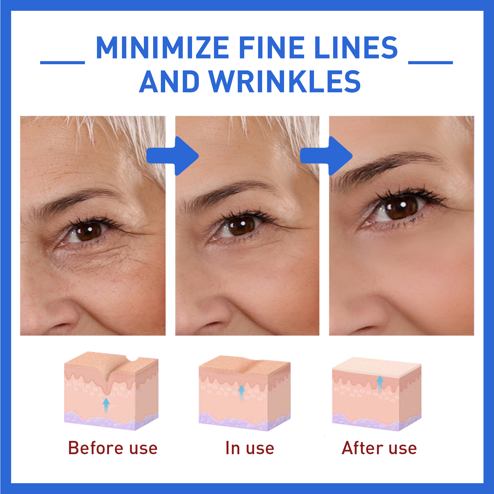 West Month Botox Stock Solution Anti-wrinkle Facial Serum Lifting Firming Anti-aging Fade Fine Lines Essence Collagen Nourishing Moisturizing Skin Care Minimize Pores Anti-aging Wrinkle Firming Essence Fade Fine Line Essence For （30ml）. 