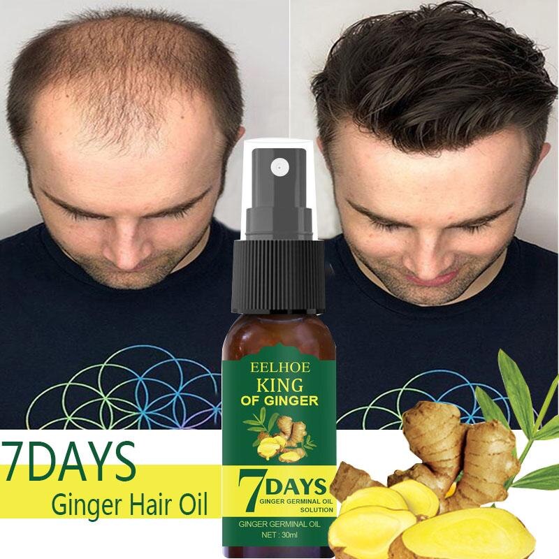 7 Day Ginger Hair Growth Essence Germinal Serum Essence Oil Natural ...