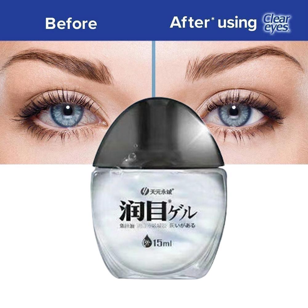 15g Cod Liver Oil Eye Drops Relieve Dry Eyes And Swelling Relieve And Visual Blurred Fatigue And V6a4. 