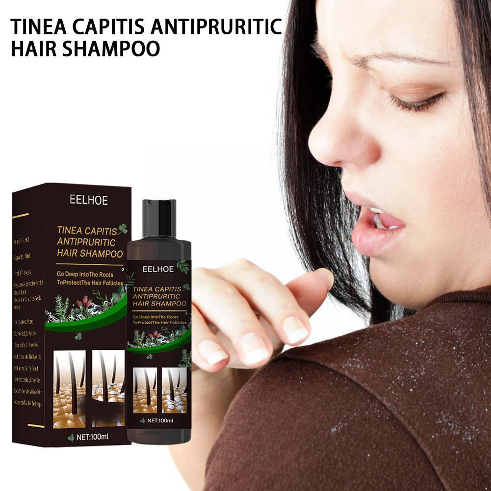 EELHOE 100ml Tinea Dispelling Anti-itching Shampoo Anti-dandruff Shampoo Hair Shampoo Treatment Oil Refreshing Control. 