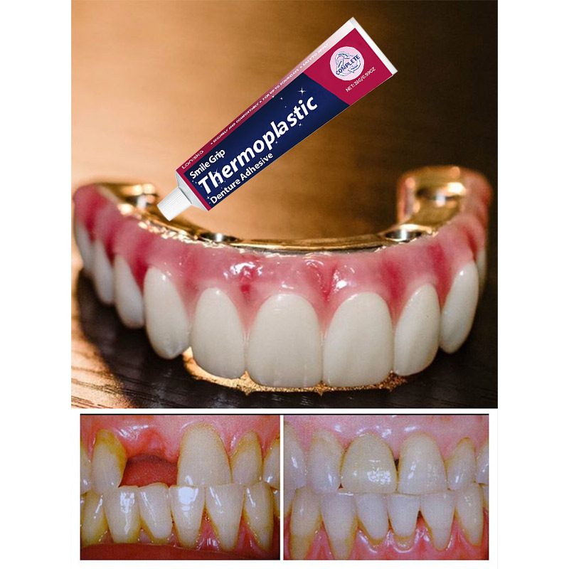 Comfort Denture Adhesives Glue Teeth Care Thermoplastic Denture Silicone Reline Kit Adhesive Cushion Friction Fixed Dentures