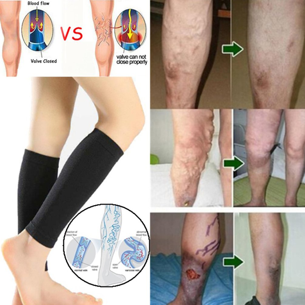 【Xiaofeng】Calf Leg Compression Socks Shin Splint Calf Pain. 