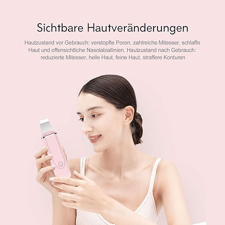 Xiaomi MS7100 InFace Ultrasonic Ionic Cleaner Face Scrubber Peeling Machine merek. 