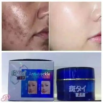 anti freckle