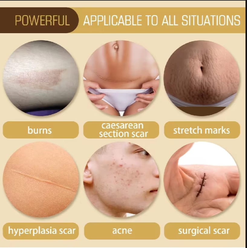 Scar Repair Skin Essential Oil Natural Pure Remove Ance Burn Strentch Marks Scar Removal Skin Therapy Oil Remove Scars Stretch Marks Serum Moisturizing Nourish Improve Rough Smooth Fine Lines Lifting Firming Body Care 30ml. 
