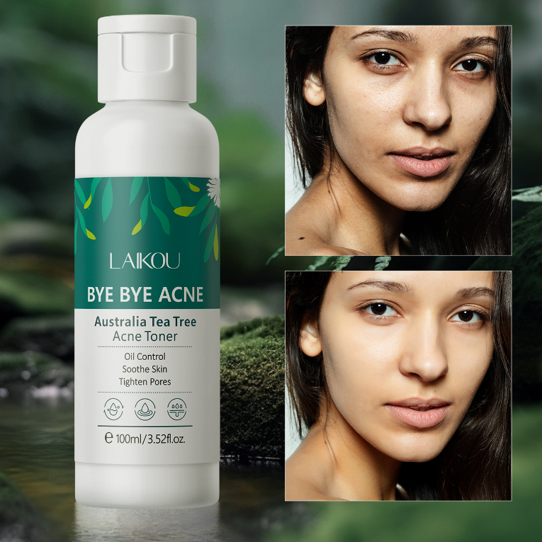 LAIKOU Australia Tea Tree Acne Toner Soothe Skin Oil Control Reduce Acne Pimples Tighten Shrink Pores- 100ml