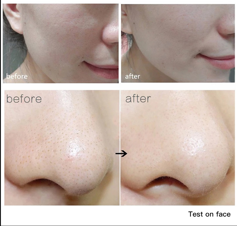 Cleansing Cream Facial Foam Cleanser Gel Deep Pore Cleansing Remove Blackheads Face Wash Skin. 
