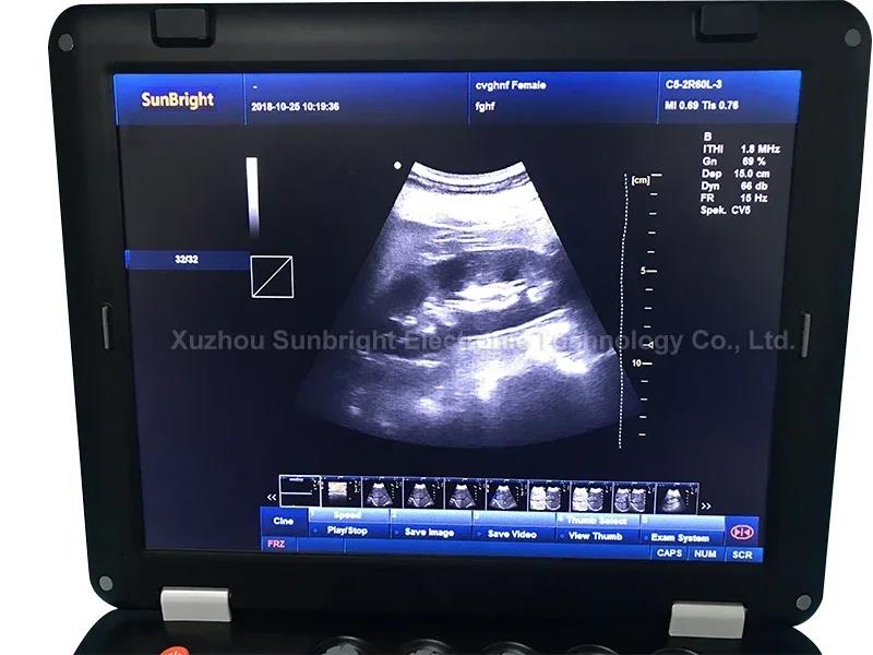 High-end Digital Medical Portable Echo Ultrasound Device 3D 4D Machine. 