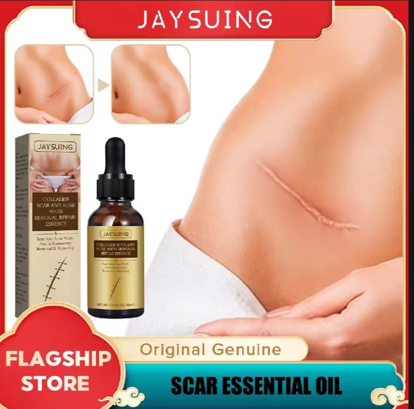 Scar Repair Skin Essential Oil Natural Pure Remove Ance Burn Strentch Marks Scar Removal Skin Therapy Oil Remove Scars Stretch Marks Serum Moisturizing Nourish Improve Rough Smooth Fine Lines Lifting Firming Body Care 30ml. 
