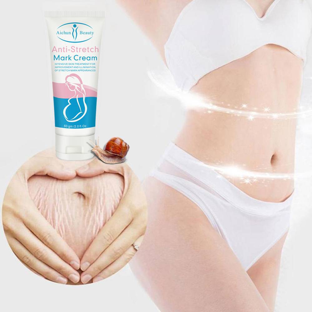 Aichun Beauty Anti-Stretch Mark Removal Cream for Mother - 50 ml. 