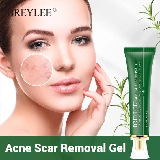 BREYLEE Acne Scar Removal Gel Fade Acne Marks Spots Remove Skin Pigmentation Soothing Prevent Acne Treatment Serum Essence -30gm