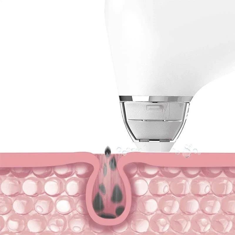DOCO Ultra-micro Bubble Pore Vacuum Cleaner Blackhead Remover. 