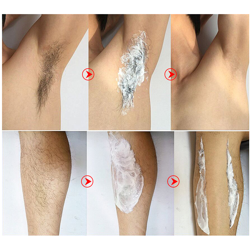 LANBENA Hair Removal Cream Removal Depilation Gentle Not Stimulating Repairing Painless Epilator Nourishing Effective Body Care. 