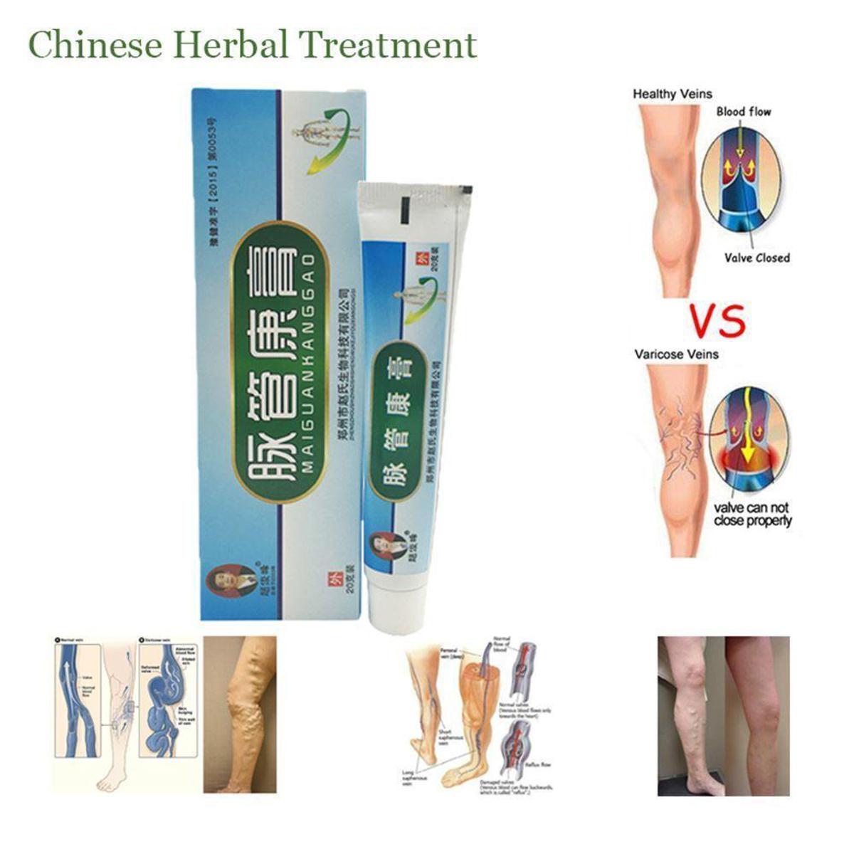 【The Edge of Beauty】New 2PC / et Medicine Varicoe Cream