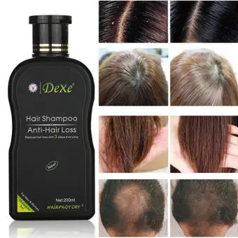 Dexe Hair Shampoo Anti Hair Loss Chinese Herbal Hair Growth