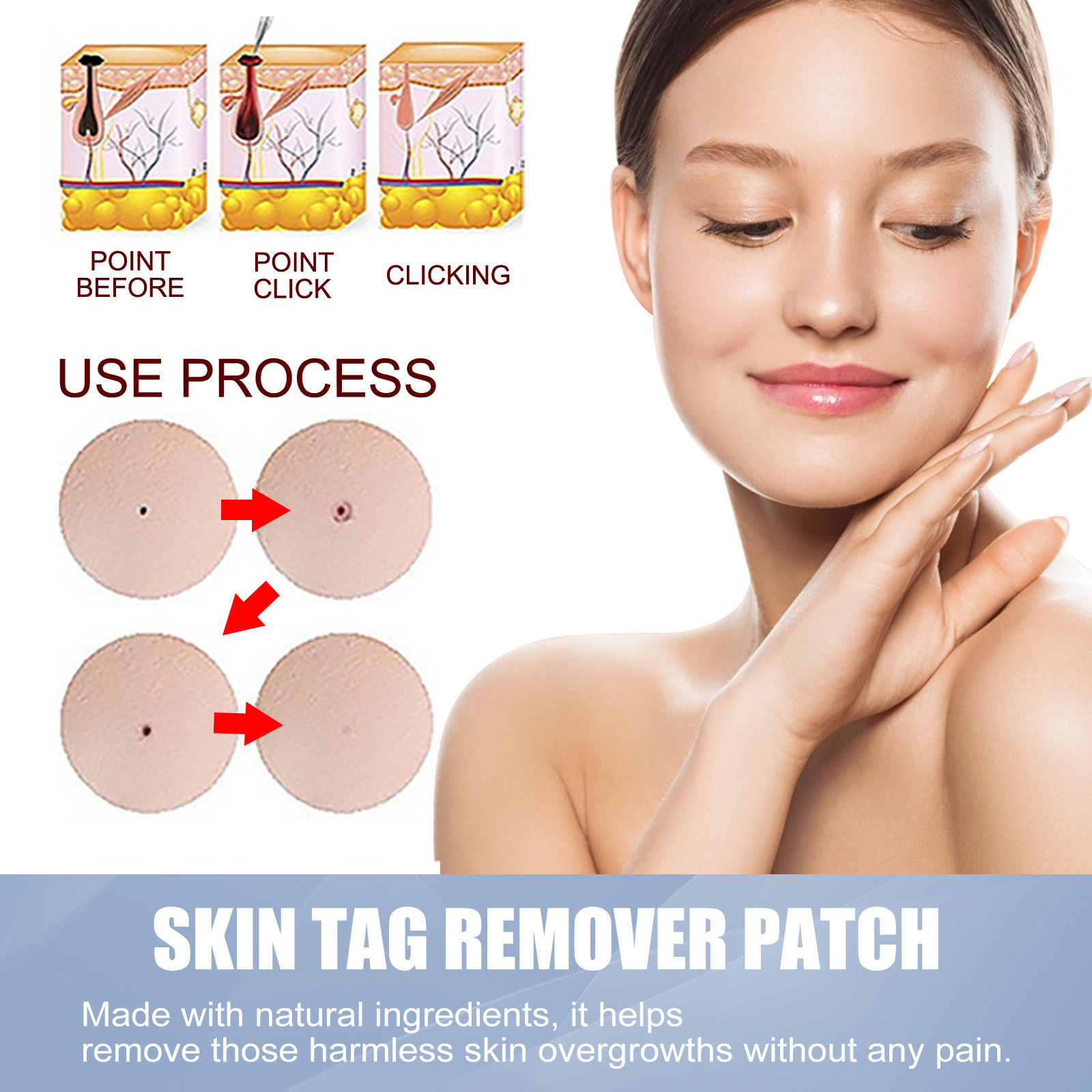 144pcs/box invisible acne patch wart patch remover pimple patch Anti-Acne Spots Marks Concealer Repair Sticker Waterproof. 