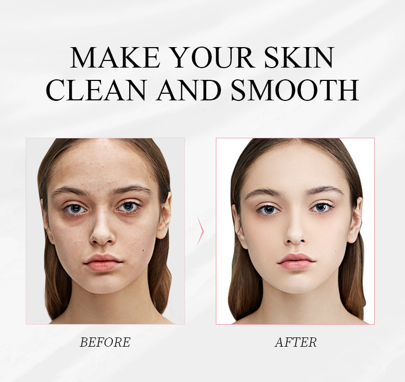 LAIKOU 5 Pcs/Set Sakura Pores Cleansing Hydrating Mud Mask- 5g/Each. 