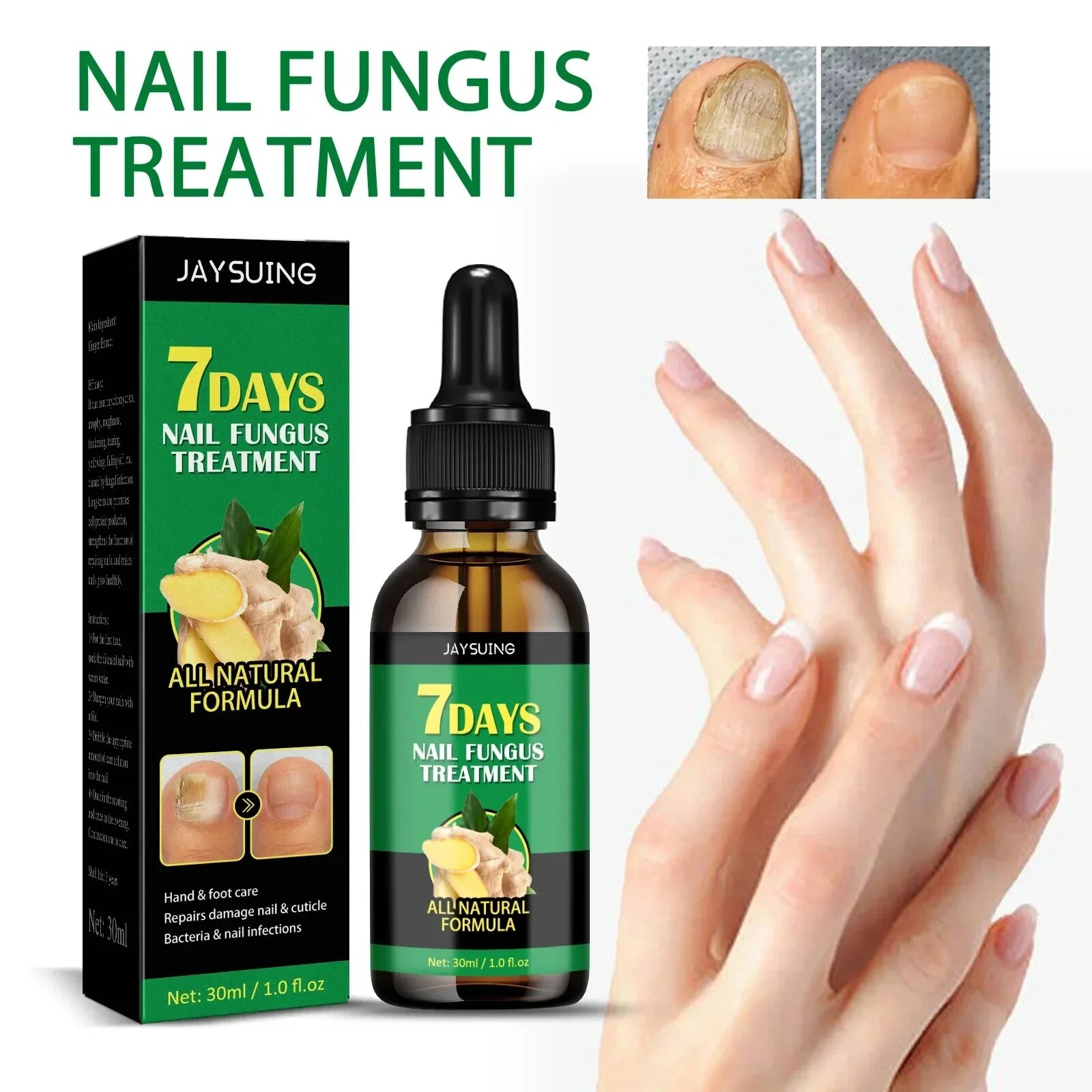 7DAYS Repair Nail Fungus Treatments Essence Foot Care Serum Toe Nails Fungal Removal Gel Anti-Infection Onychomycosis Care Tool. 