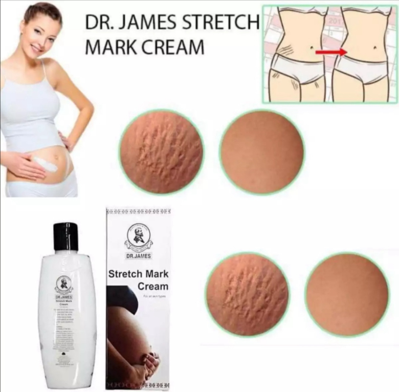 Dr James Stretch Mark Cream 200Ml