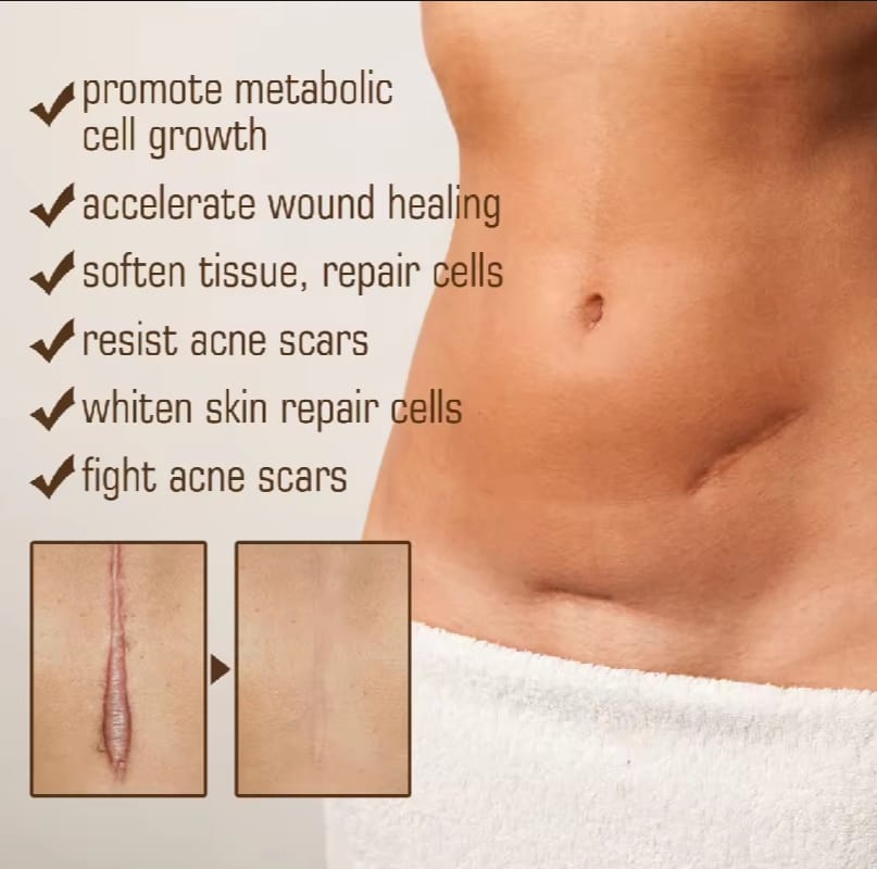 Scar Repair Skin Essential Oil Natural Pure Remove Ance Burn Strentch Marks Scar Removal Skin Therapy Oil Remove Scars Stretch Marks Serum Moisturizing Nourish Improve Rough Smooth Fine Lines Lifting Firming Body Care 30ml. 