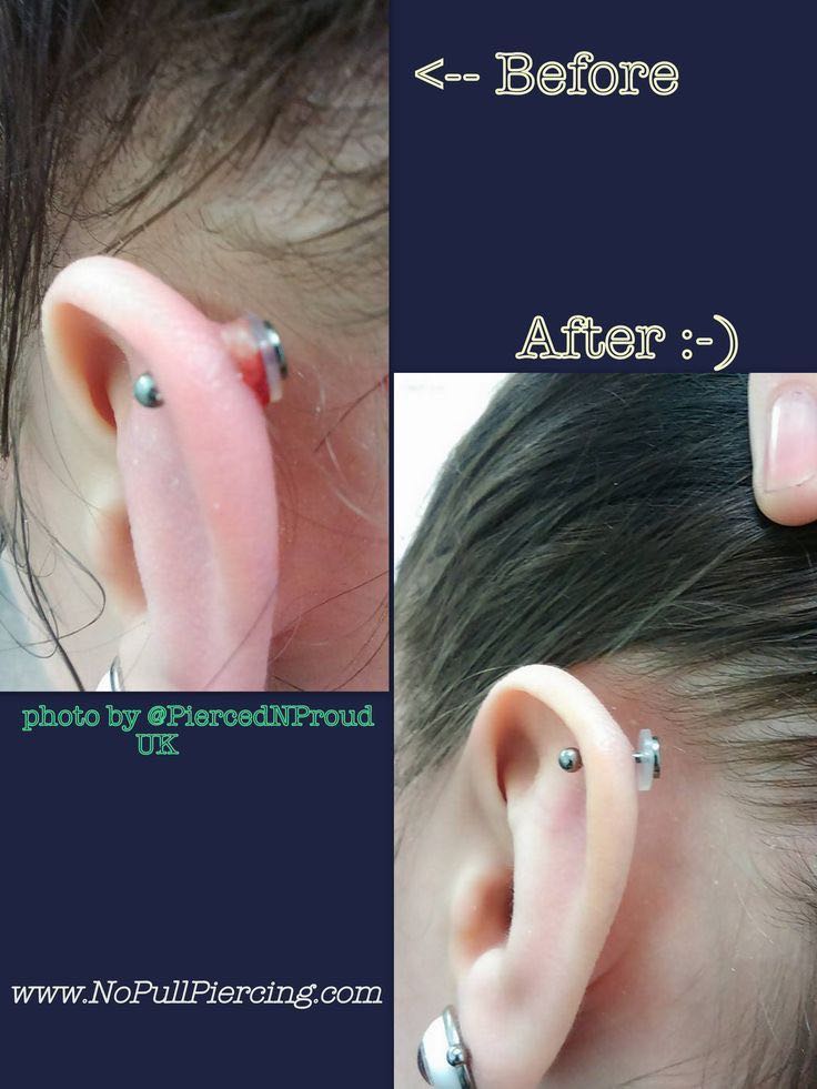 Piercing Healing Silicone Discs Soft Anti Hyperplasia Anti-sagging Fixed Rings for Nose Ear Cartilage Soft Gasket Spacers body. 